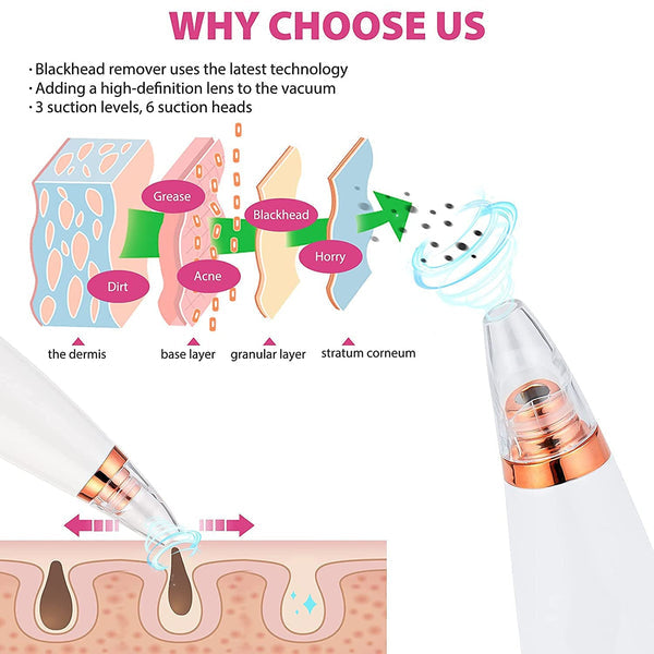 6 in 1 multifunction blackhead remover